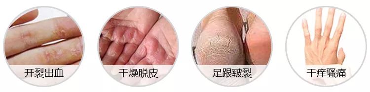 凤凰网梧桐汇商城|皮肤干痒、开裂、脱皮?用它抹一抹,立马见效