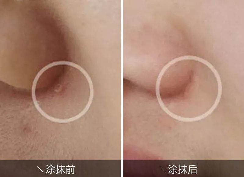 凤凰网梧桐汇商城|皮肤干痒、开裂、脱皮?用它抹一抹,立马见效