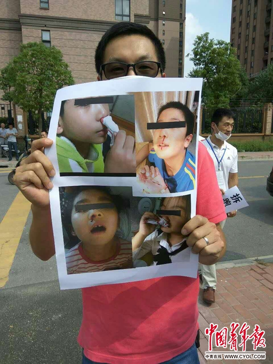 上海一小学跑道被指有“毒” 75名学生出现过敏症状