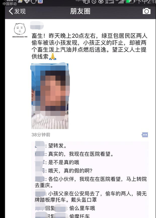 重庆8岁男童疑因阻偷车贼遭报复 头部被泼油点火
