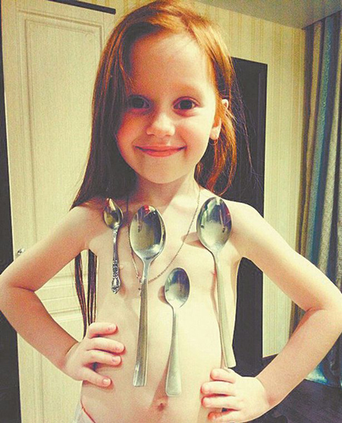 现实版万磁王：俄6岁女孩可用身体吸附金属勺