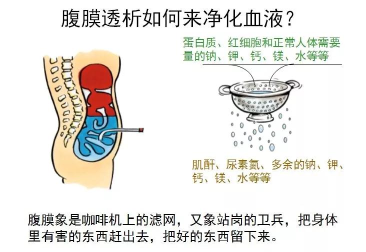 腹透?移植?肾友到底该选择何种替代疗法呢?