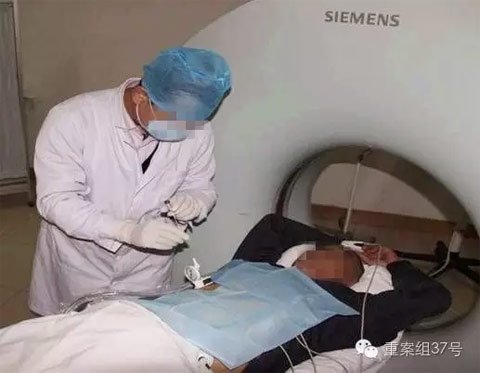 射频消融术(网络图片)