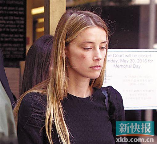 ▲艾梅伯控告德普家暴且脸上有明显的伤痕。