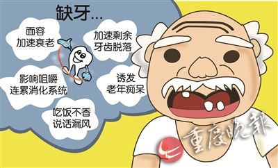 缺一齿则伤全身 修复缺牙不能等_凤凰资讯