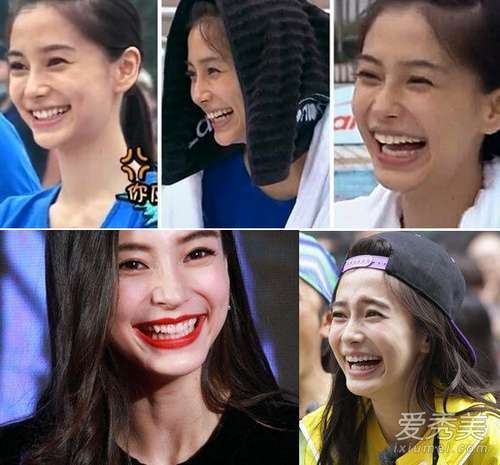 angelababy   baby笑起来不算丑,但是下巴的假体实在太明显,下巴假体