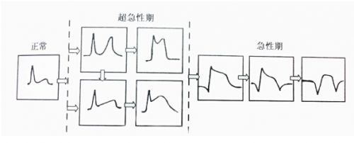 【好朋友心电图机家用100法】如何巧用好朋友