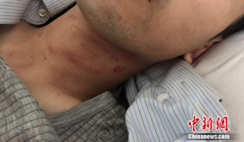 遭越南边检殴打的中国游客转院治疗 曾给3次消费