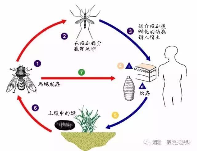 衡阳一小伙非洲归来 皮下捉出8条活蛆