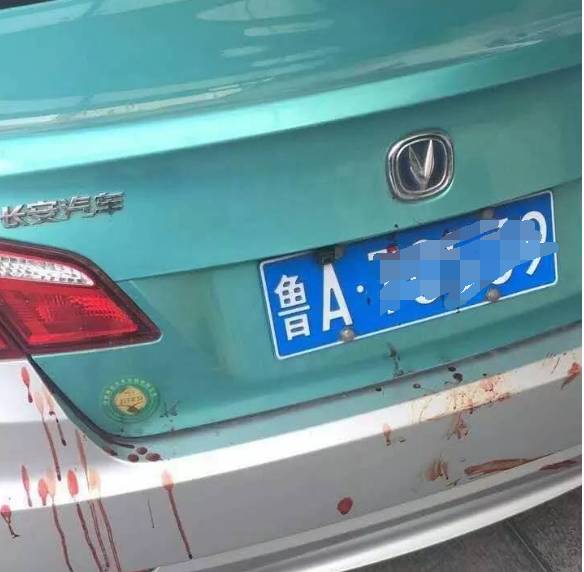 山东一出租车司机凌晨被抢劫 又被砍了4刀