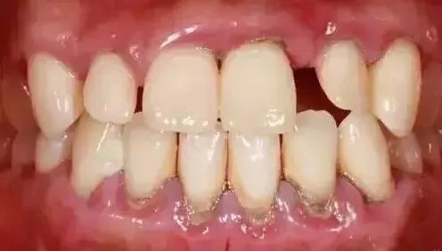 【全新体验】海南口腔医院推出无痛舒适洁牙项