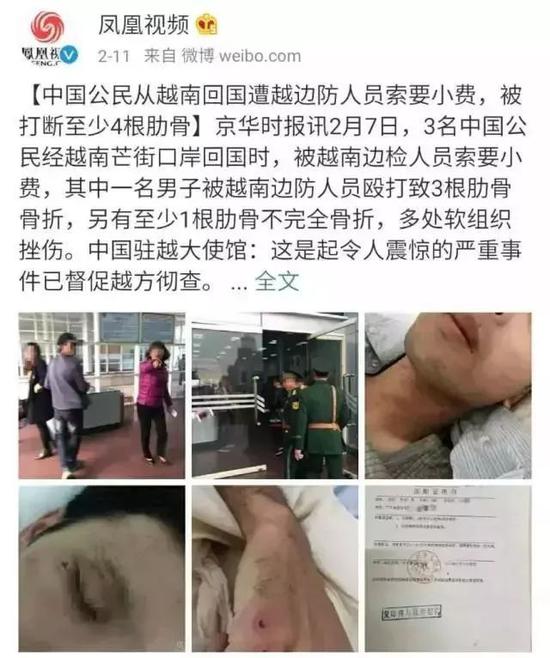 中国公民被越南边检人员索要小费不成被殴打致骨折新闻来源：凤凰视频