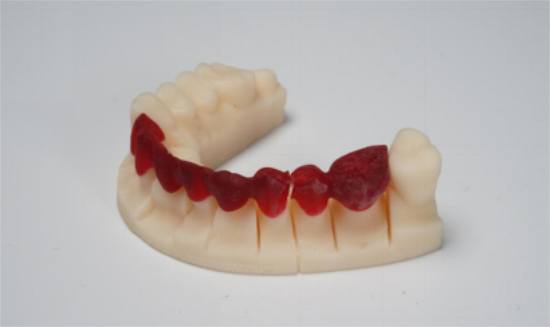 3D打印助力义齿加工业发展,黑格科技推出零租