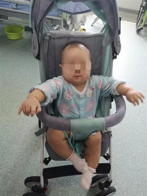 武汉半岁男婴被恶犬叼走咬穿颅骨 抢救近60天出院