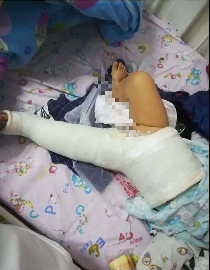 大狗撞摔致女婴十级伤残 狗主人拒赔10万元被拘15日