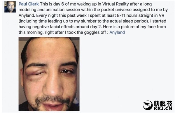 国外小伙戴着VR头盔睡觉：起床一照镜子惊呆