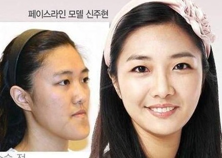 为什么韩国美女都长一个样？