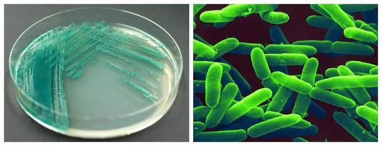 绿脓杆菌的分离培养及电镜照片（图片来源：中国科学院微生物研究所）