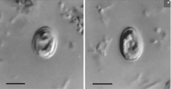 人类粪便中的隐孢子虫卵母细胞（图片来源：维基）