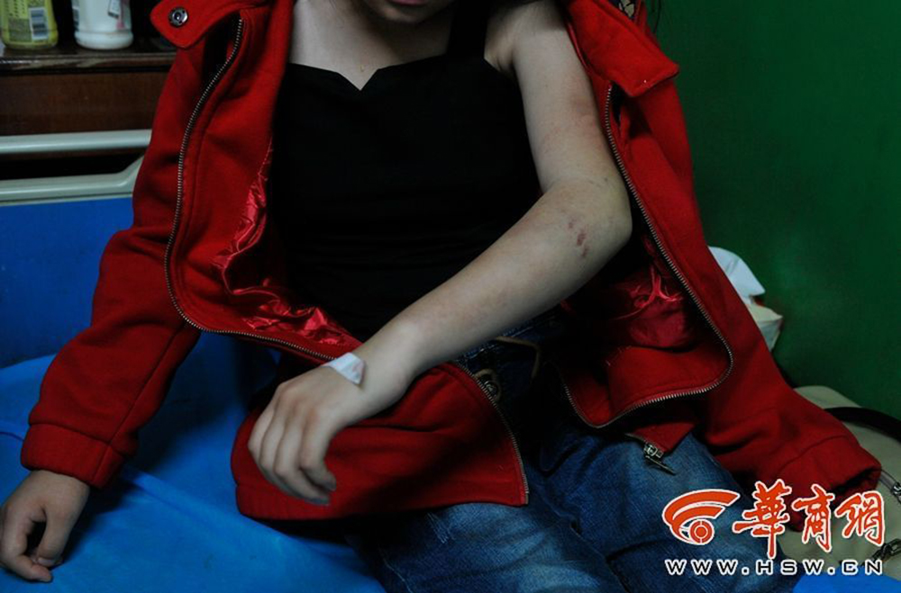 14岁女孩被同学围殴2小时 遭踢下体划刀片