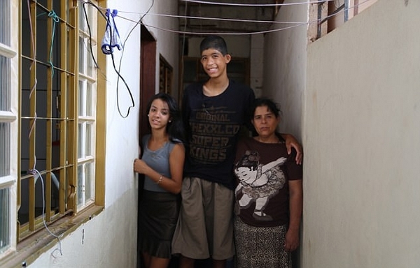 12岁男孩患巨人症身高23米冒险手术治疗