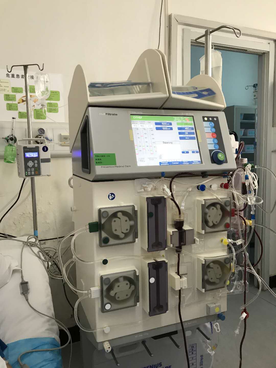 市五院内科六病区开展首例crrt治疗新技术