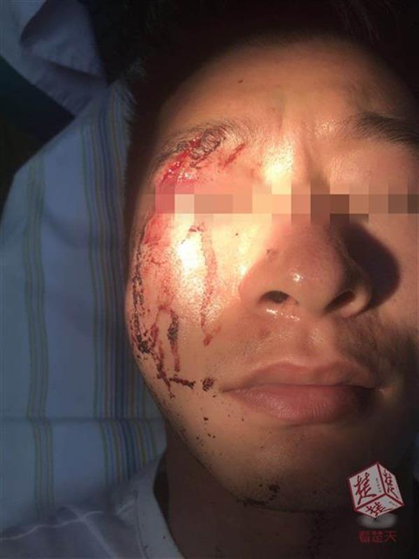 脚手架扣件从天而降 男店主被砸得头破血流