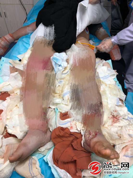 尚一网记者曾兰摄"这几年孩子读大学,就靠他一个人到国外打工赚钱.