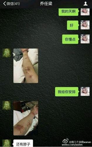 乔任梁生前最后综艺脖子上有明显伤痕