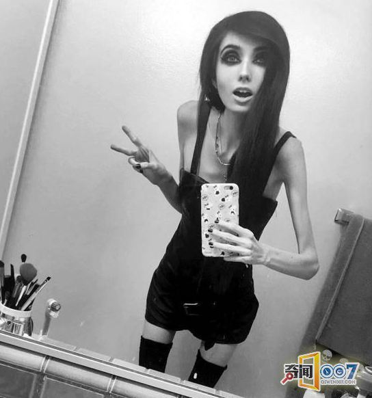 网红妹子瘦到30斤 出镜似僵尸