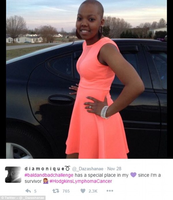 英女性"光头自拍挑战"席卷社交媒体(组图)