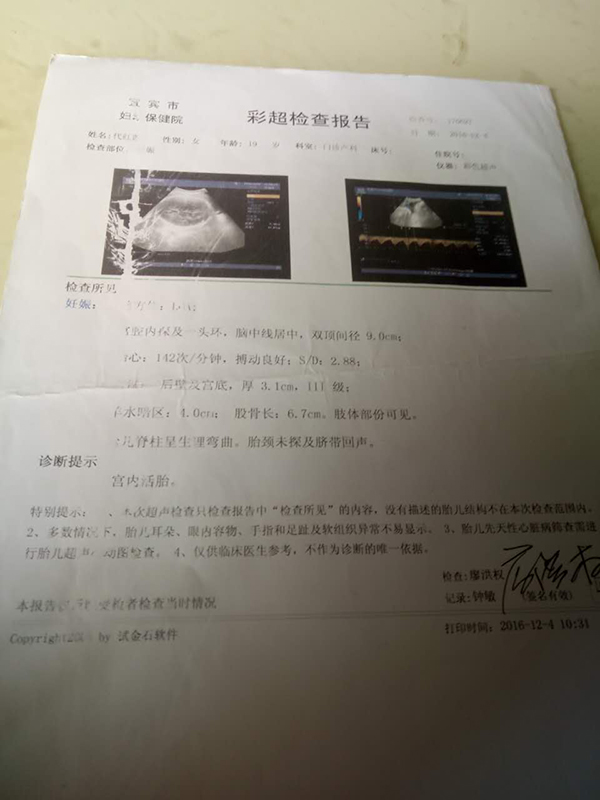 怀孕超声报告单图片