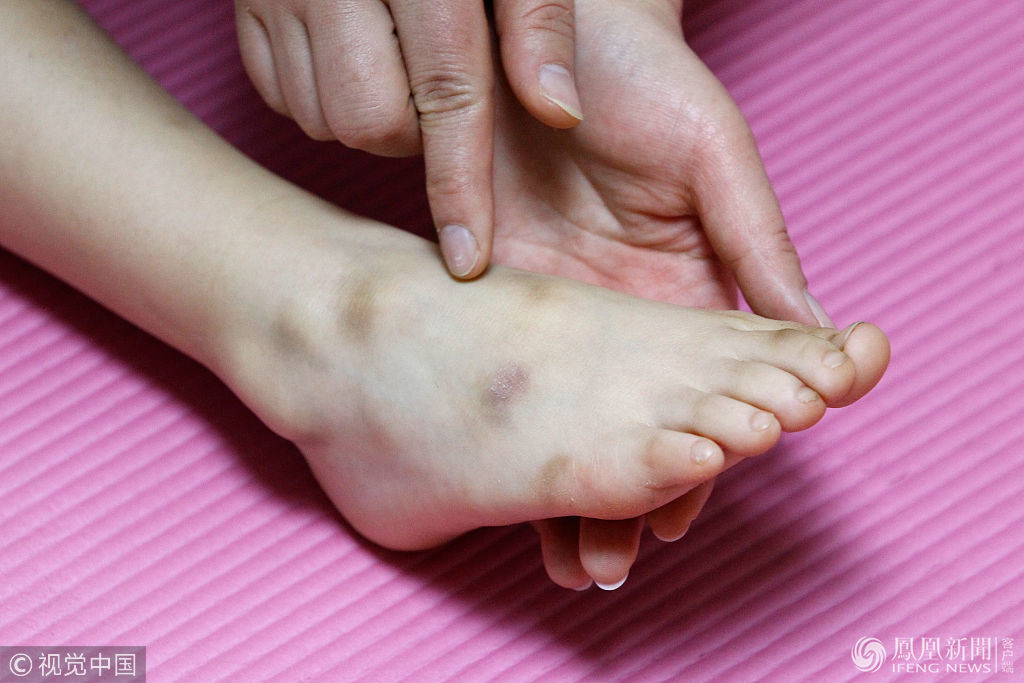 6岁女孩苦练钢管舞 获全国冠军