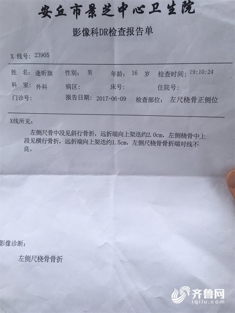 安丘16岁小伙中考前摔断手臂 坚持考试结束再手术