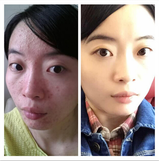 专注痘肌调理领域——专访轻彩品牌创始人