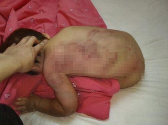 被打小孩照片原标题:虐待女儿发图给前妻炫耀?